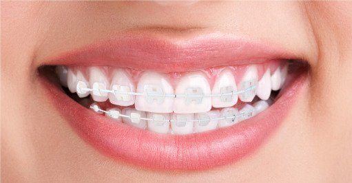 Ortodoncia -Mercat Sants Dental