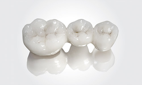 Protesis dentales - Mercat Sants Dental